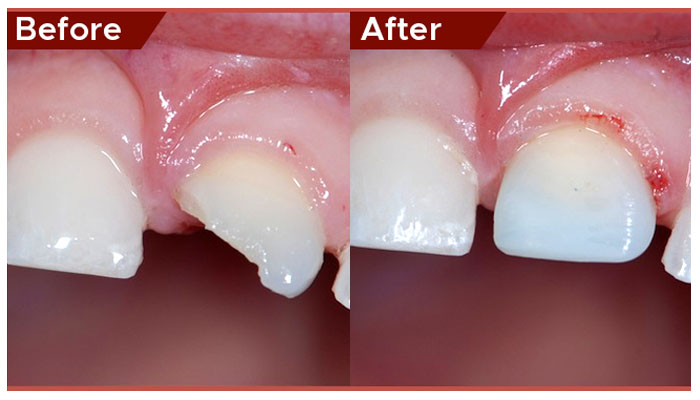 pediatric dentist in Abu Dhabi